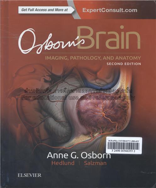 The Human Brain in 1969 Pieces: Structure, Vasculature, Tracts